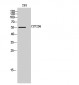 CYP2D6 Polyclonal Antibody